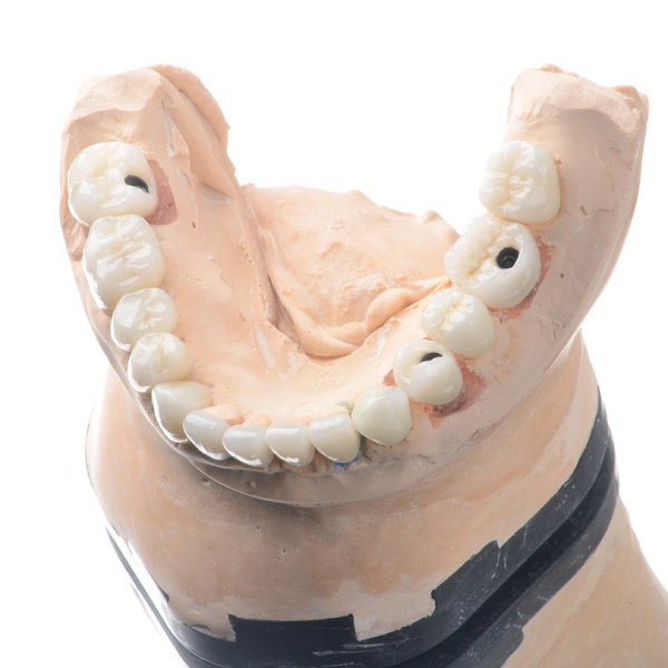 Foto 2 Dentista na Paulista Sakakura Odontologia - Harmonização Facial - Lente de Contato Dental SP - Clínica de Odontologia SP