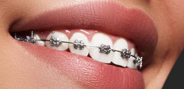 Foto 3 Clínica Odontológica - Dra Adriana Pellegrini Odontologia Dra Adriana