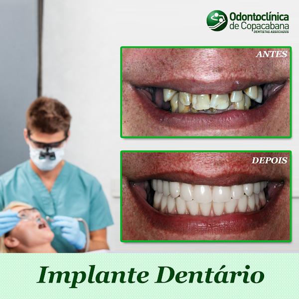 Foto 4 Odontoclínica de Copacabana Dentistas Associados