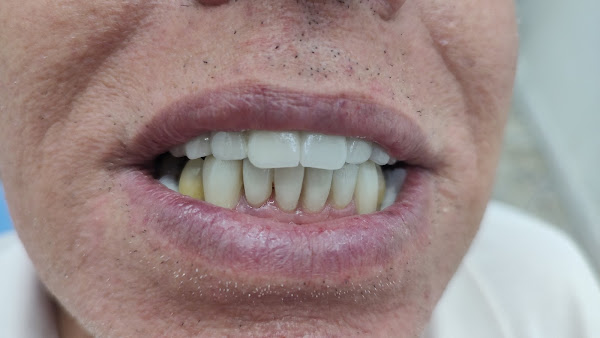 Foto 1 Dra. Andrea Leonardo (Cirurgiã Dentista, Implantodontia e Harmonização Facial)