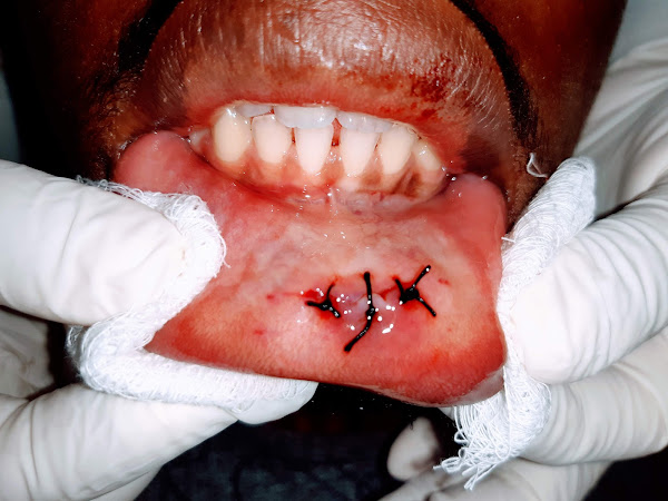 Foto 1 ESTOMATOLOGISTA Doenças da Boca Dr Alexandre Giannini