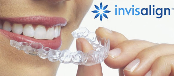 Foto 1 Angela Figueiredo