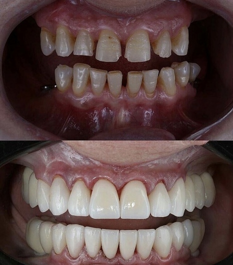 Dr. Hamza Elfwirs, Dentista