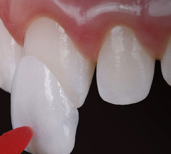 Foto 1 Inspiratto Odontologia: Invisalign, Clareamento Dental, Lentes de Contato Dentais, Harmonização Facial, Ortodontia, Brasília DF