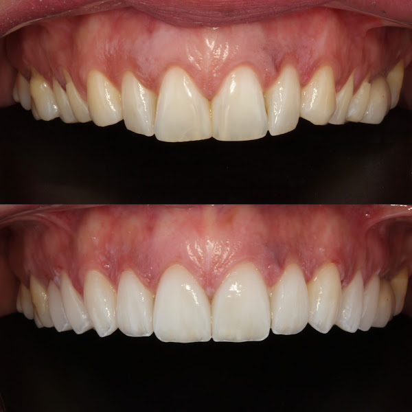 Foto 1 LOE+ Odontologia