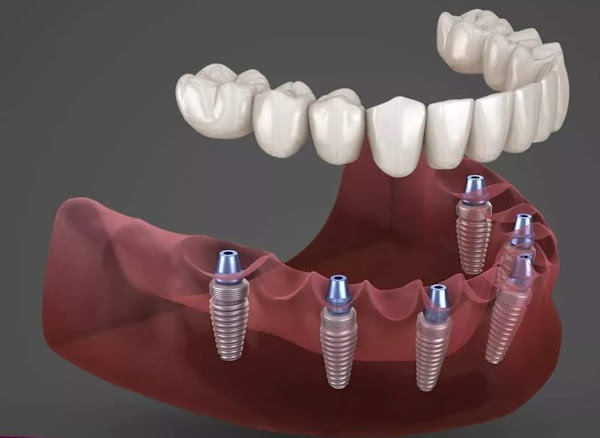 Foto 4 Siga Odontologia - Asa Sul Shopping Pátio Brasil Foto 4 Siga Odontologia - Asa Sul Shopping Pátio Brasil