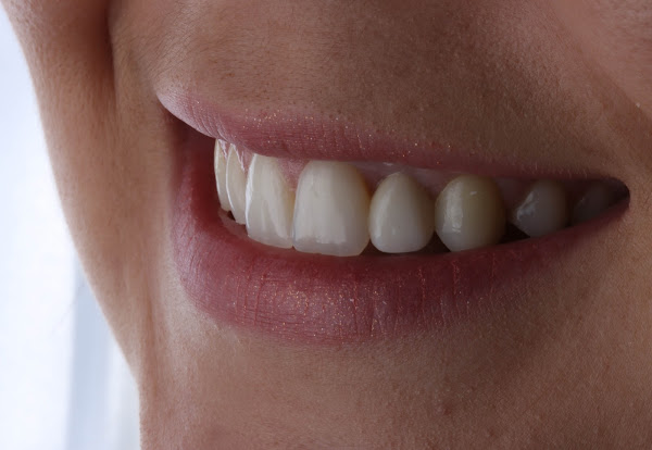 Foto 2 IEEP Odontologia Especializada