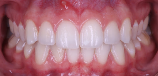 Exitus odontologia especializada