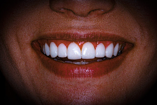 Foto 2 Exitus odontologia especializada