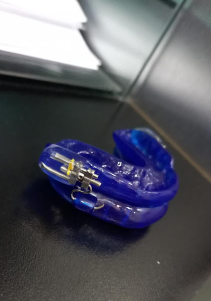 Foto 2 Ronco e Apneia do Sono - Dra.Norma Melucci - Tratamentos