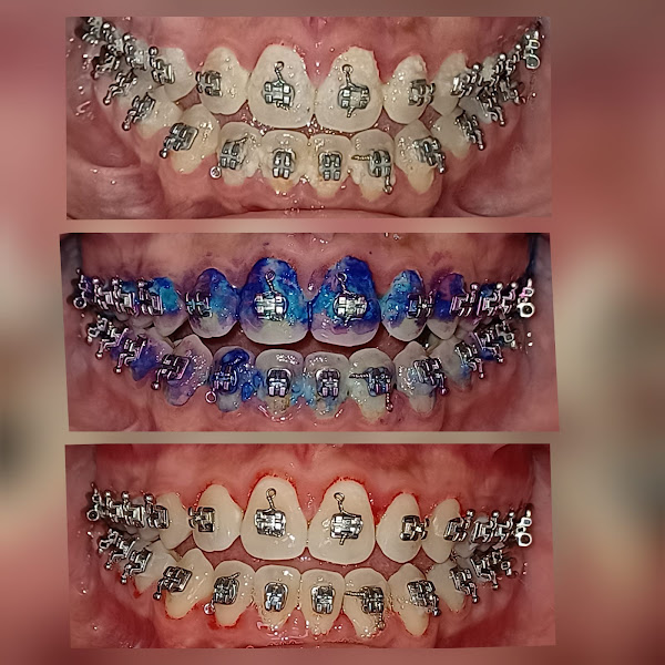 Foto 2 Dra Márcia Navarro - Ortodontista Salvador