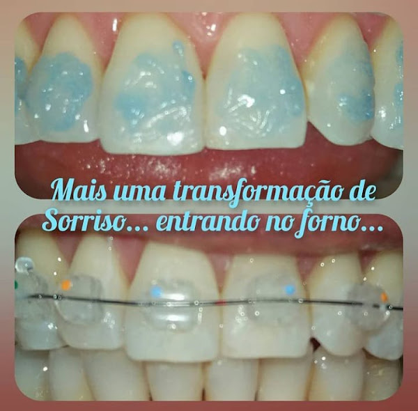 Foto 4 Dra Márcia Navarro - Ortodontista Salvador