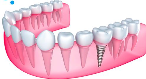 Foto 2 Saúde Dental Serviços Odontológicos