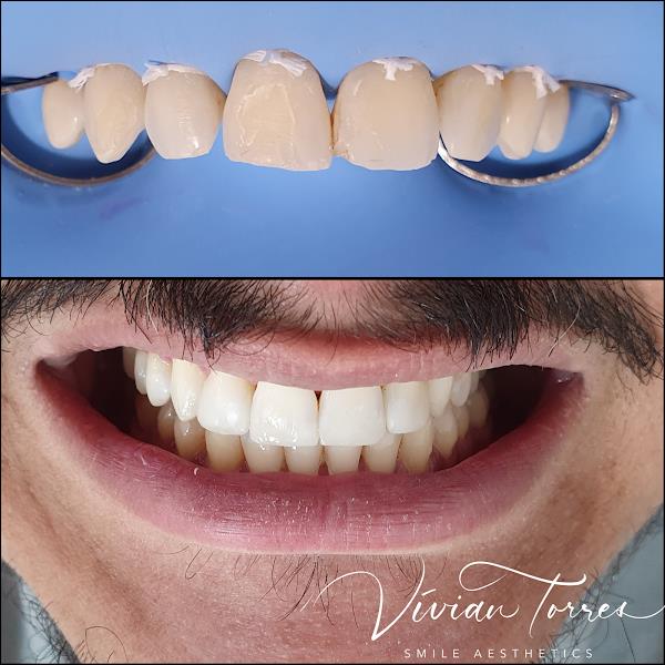 Foto 3 Vívian Torres Odontologia