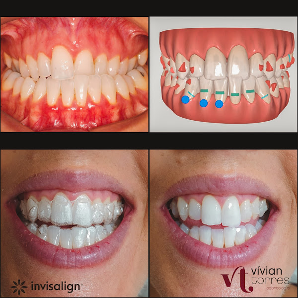 Foto 5 Vívian Torres Odontologia