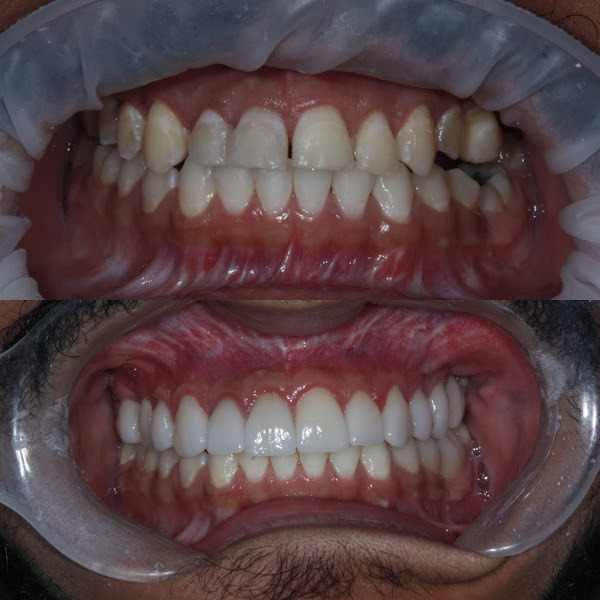 Dr. Eduardo Henrique Neves