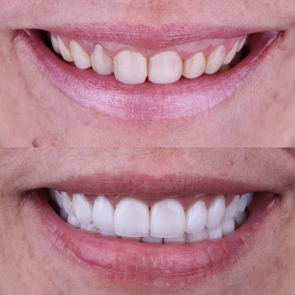 Foto 1 Dental Esthetic Center by Rogerio Marcondes | Odontologia estética, clinica odontológica e muito mais.