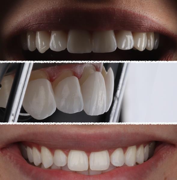 Ortoestética Odontologia Água Verde Curitiba