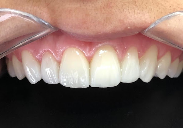 Foto 1 Odontologia - Dra Marluci Karine Wodonis