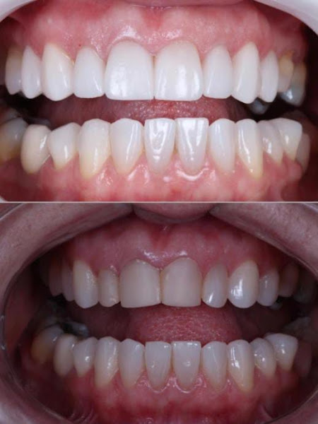 Foto 3 Odontologia - Dra Marluci Karine Wodonis