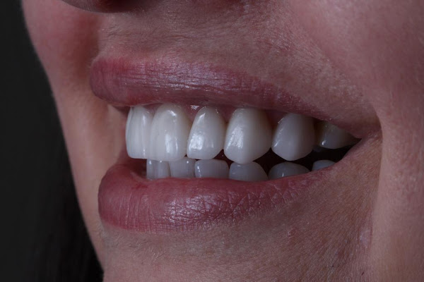 Foto 4 Odontologia - Dra Marluci Karine Wodonis Foto 4 Odontologia - Dra Marluci Karine Wodonis