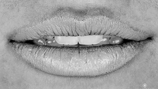 Henrique Pires Dental Studio - Odontologia estética, lentes de contato dental, implantes e reabilitação oral