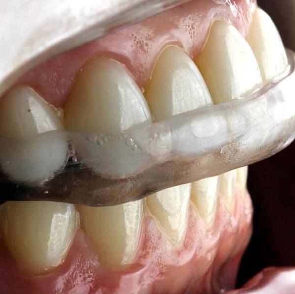 Foto 1 Oralle Studio Dental - Dentista Maringá - Invisalign