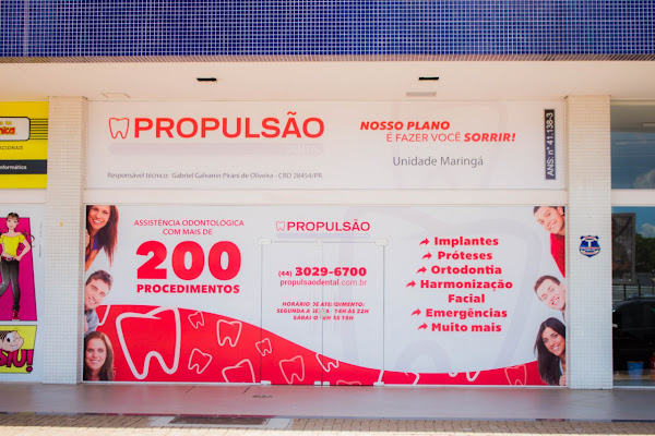 Propulsão Dental | Dentista em Maringá