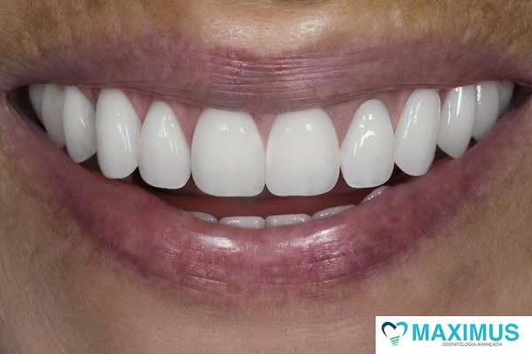 Foto 3 Maximus Odontologia Avançada