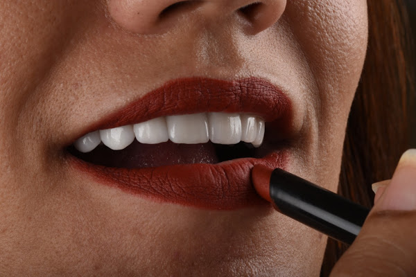 Foto 5 Implante Ingá