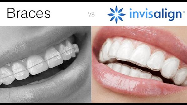 Foto 2 Dr Sérgio Utida - Invisalign Doctor - Ortodontista - Ortodontia - Dentista