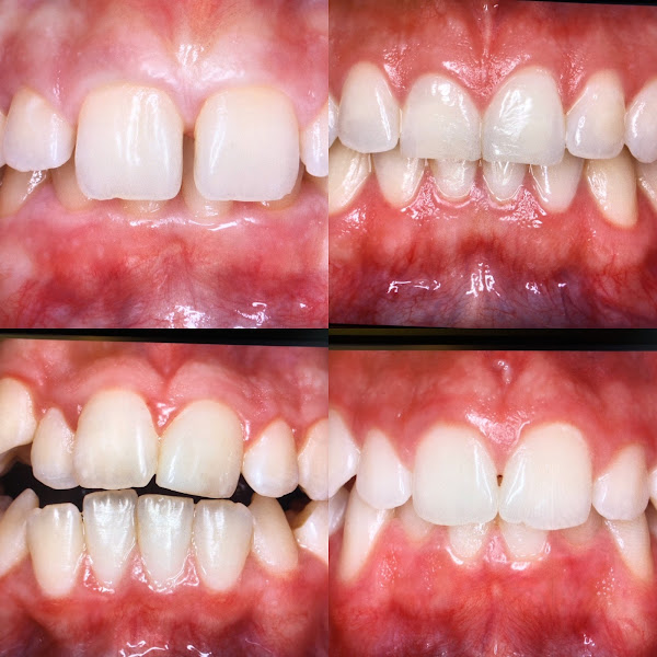 Foto 1 Ana Rosa Girardi Ortodontia