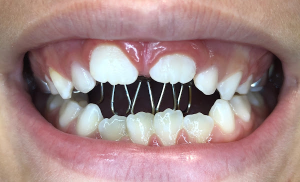 Foto 5 Ana Rosa Girardi Ortodontia