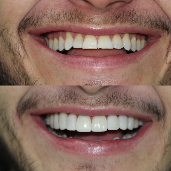 Foto 1 Blanca Odontologia