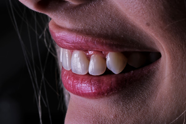 Foto 3 BLISS estética e saúde bucal - Consultório Odontológico