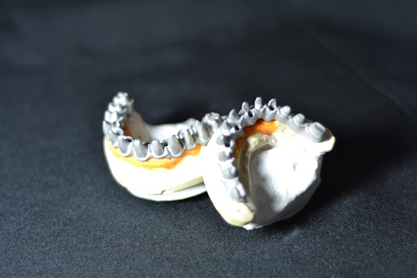 Higaki Odontologia - Implantes Dentários