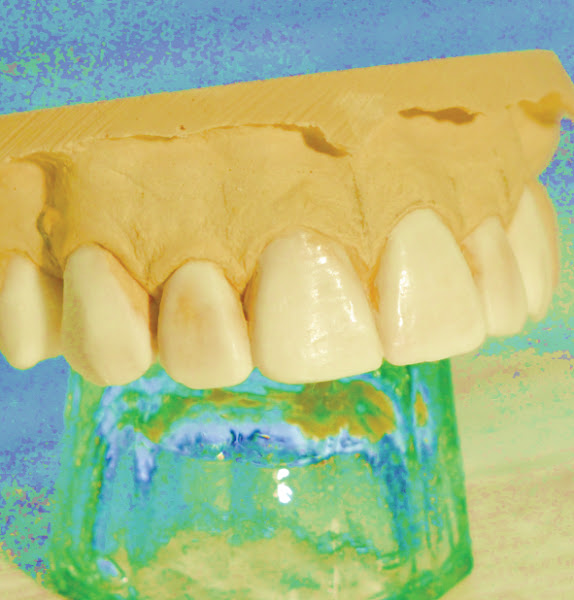 Foto 1 Higaki Odontologia - Implantes Dentários
