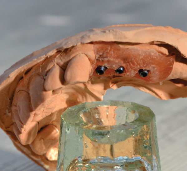 Foto 2 Higaki Odontologia - Implantes Dentários