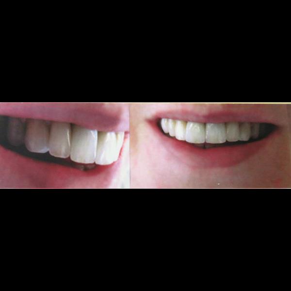 Foto 2 Vania Biglia - Dentista