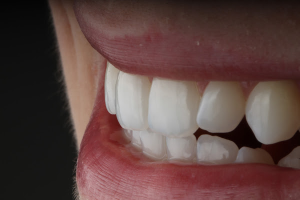 Odontologia Dr. Gustavo Romano