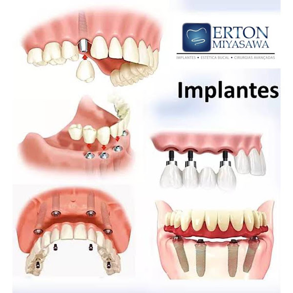Foto 4 MIYASAWA ODONTOLOGIA SOROCABA