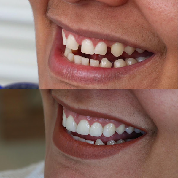Dra Giorgia Lúcio - Odontologia Estética