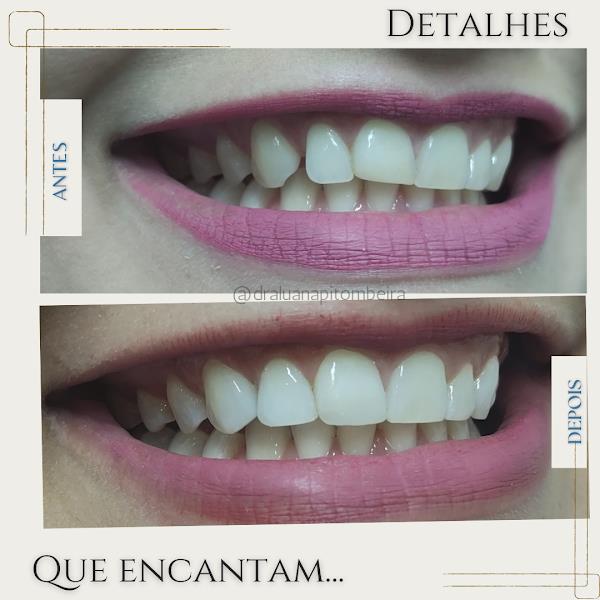 Foto 2 Luana Pitombeira Odontologia Especializada