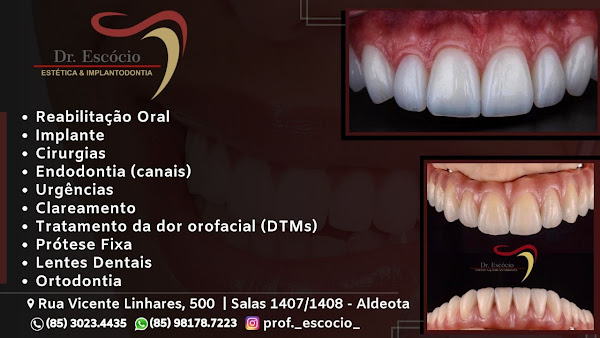 CLINICA DR. ESCÓCIO ESTÉTICA & IMPLANTODONTIA CLINICA DR. ESCÓCIO ESTÉTICA & IMPLANTODONTIA