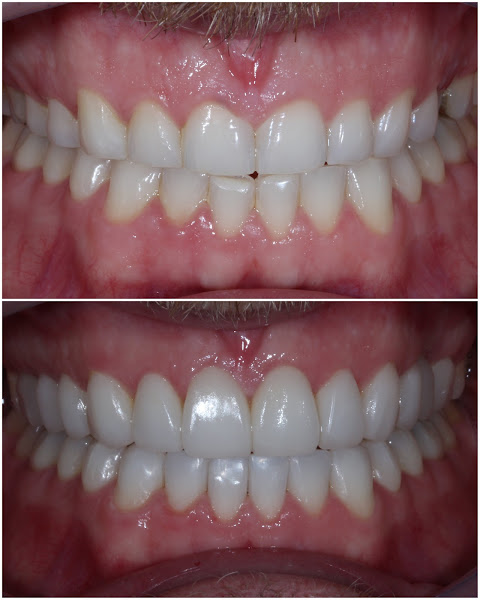 Odontológica Odontologia Estética Odontológica Odontologia Estética