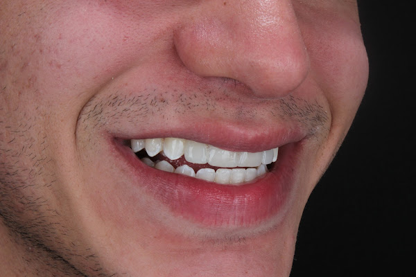 Mateus Davila Odontologia