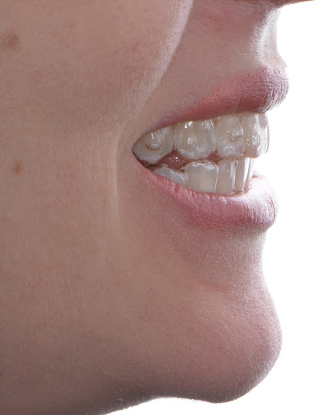 Dra Juliana Fava - Ortodontista