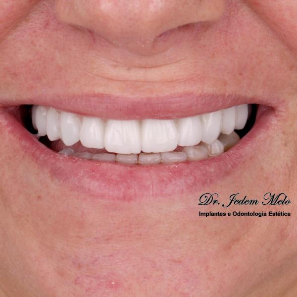 Foto 1 Clínica Orto e Implante