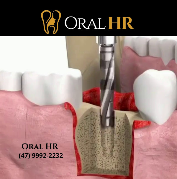 Foto 2 Oral HR