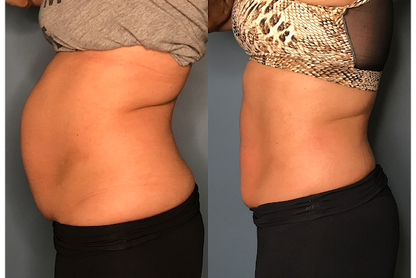 Foto 1 Dra Poliana Ruzza